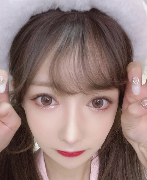 Rちゃん　整形　やりすぎ