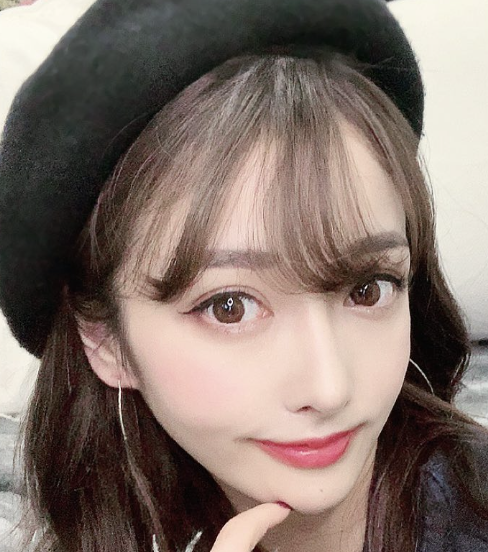 Rちゃん　整形　やりすぎ